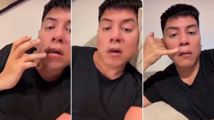 Mariano de la Canal contó que un perro lo atacó y mostró las heridas en su rostro